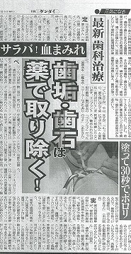 日刊ゲンダイ【歯垢・歯石は薬で取り除く！】